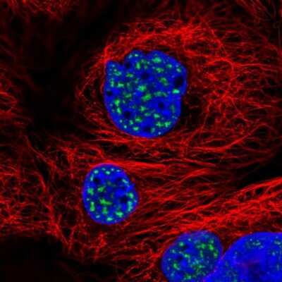 <b>Independent Antibodies Validation. </b>Immunocytochemistry/Immunofluorescence: SON Antibody [NBP2-55411] - Staining of human cell line A-431 shows localization to nuclear speckles.