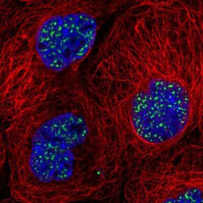 Immunocytochemistry/Immunofluorescence: SON Antibody [NBP2-55412] - Staining of human cell line A-431 shows localization to nuclear speckles.