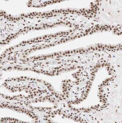 Immunohistochemistry-Paraffin: SON Antibody [NBP1-88706] - Staining of human prostate shows moderate to strong positivity in nuclear speckles in glandular cells.