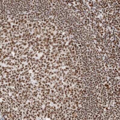 Immunohistochemistry-Paraffin: SON Antibody [NBP1-88706] - Staining of human tonsil shows moderate to strong positivity in nuclear speckles in germinal center cells.