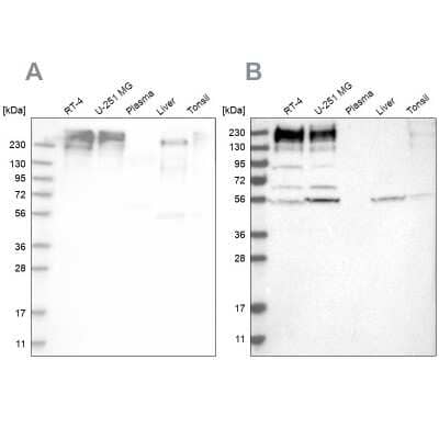 Western Blot: SON Antibody [NBP2-55411] - Analysis using Anti-SON antibody NBP2-55411 (A) shows similar pattern to independent antibody NBP1-88706 (B).