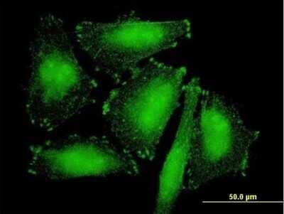 Immunocytochemistry/ Immunofluorescence SORBS2 Antibody