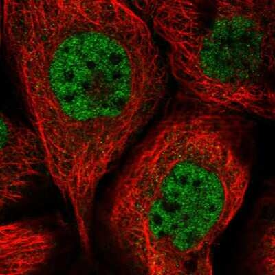 Immunocytochemistry/Immunofluorescence: SORBS2 Antibody [NBP2-32672] - Immunofluorescent staining of human cell line A-431 shows localization to nucleoplasm.