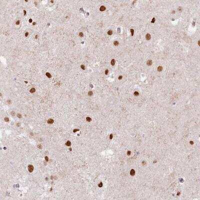 Immunohistochemistry: SORBS2 Antibody [NBP1-88836] - Staining of human hippocampus shows strong nuclear positivity in neuronal cells.