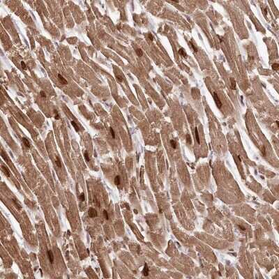 Immunohistochemistry-Paraffin: SORBS2 Antibody [NBP2-32672] - Staining of human heart muscle shows strong nuclear and moderate cytoplasmic positivity in myocytes.