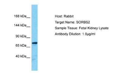 Western Blot: SORBS2 Antibody [NBP2-88335] - Host: Rabbit. Target Name: SORBS2. Sample Type: Fetal Kidney lysates. Antibody Dilution: 1.0ug/ml