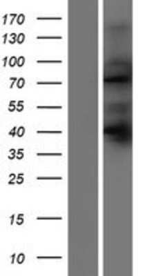 Western Blot: SORBS2 Overexpression Lysate (Adult Normal) [NBP2-06568] Left-Empty vector transfected control cell lysate (HEK293 cell lysate); Right -Over-expression Lysate for SORBS2.
