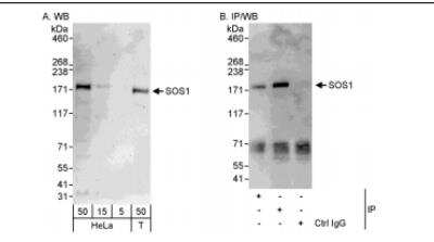 Western Blot: SOS1 Antibody [NBP1-05955] - Whole cell lysate from HeLa (5, 15 and 50 ug for WB; 1 mg for IP, 20% of IPloaded) and HEK293T (T; 50 ug) cells. Antibodies: Affinitypurified rabbit anti-SOS1 antibody  used for WB at 0.04 ug/ml (A) and 1 ug/ml (B) and used for IP at 3 ug/mg lysate. SOS1 was also immunoprecipitated by rabbitanti-SOS1 antibody, which recognizes an upstream epitope. Detection: Chemiluminescence with exposure times of 3 minutes (A) and 30 seconds (B).