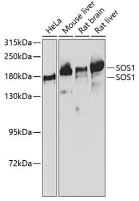 Western Blot: SOS1 Antibody [NBP2-94657] - Analysis of extracts of various cell lines, using SOS1 at 1:1000 dilution. Secondary antibody: HRP Goat Anti-Rabbit IgG (H+L) at 1:10000 dilution. Lysates/proteins: 25ug per lane. Blocking buffer: 3% nonfat dry milk in TBST. Detection: ECL Basic Kit . Exposure time: 90s.