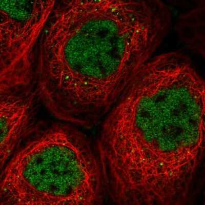 Immunocytochemistry/Immunofluorescence: SOS2 Antibody [NBP2-55873] - Staining of human cell line A-431 shows localization to nucleoplasm & vesicles.