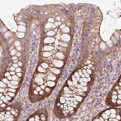 Immunohistochemistry-Paraffin: SOS2 Antibody [NBP2-33487] - Staining of human colon shows strong cytoplasmic and membranous positivity in glandular cells.