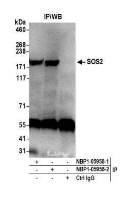 <b>Independent Antibodies Validation and Biological Strategies Validation.</b>Immunoprecipitation: SOS2 Antibody [NBP1-05958] - Detection of human SOS2 by western blot of immunoprecipitates. Samples: Whole cell lysate (0.5 or 1.0 mg per IP reaction; 20% of IP loaded) from HeLa cells prepared using NETN lysis buffer. Antibodies: Affinity purified rabbit anti-SOS2 antibody NBP1-05958 (lot NBP1-05958-2) used for IP at 6 ug per reaction. SOS2 was also immunoprecipitated by a previous lot of this antibody (lot NBP1-05958-1). For blotting immunoprecipitated SOS2, NBP1-05958 was used at 1 ug/ml. Detection: Chemiluminescence with an exposure time of 75 seconds.