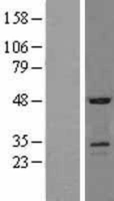 Western Blot: SOSTDC1 Overexpression Lysate (Adult Normal) [NBL1-16342] Left-Empty vector transfected control cell lysate (HEK293 cell lysate); Right -Over-expression Lysate for SOSTDC1.