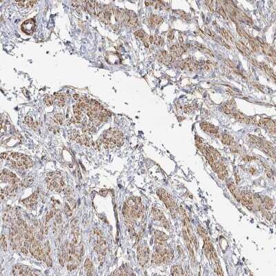 Immunohistochemistry: SOWAHD Antibody [NBP2-38081] - Staining of human smooth muscle shows moderate cytoplasmic positivity in smooth muscle cells.