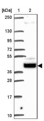 Western Blot: SOWAHD Antibody [NBP2-38081] - Lane 1: Marker  [kDa] 250, 130, 95, 72, 55, 36, 28, 17, 10.  Lane 2: Human cell line RT-4