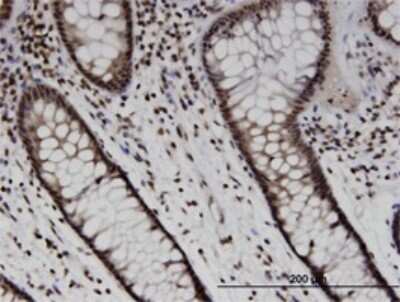 Immunohistochemistry-Paraffin: SOX10 Antibody (1E6) [H00006663-M01] - Analysis of monoclonal antibody to SOX10 on formalin-fixed paraffin-embedded human colon. Antibody concentration 1.5 ug/ml.