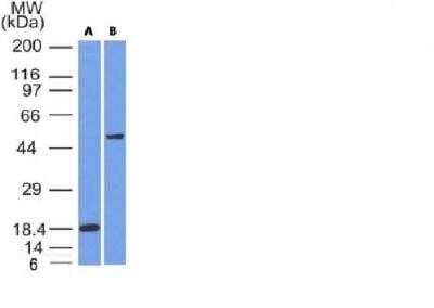 Western Blot: SOX10 Antibody (SOX10/991 + SOX10/1074) [NBP2-44476] - (A) Recombinant protein (B) A375 Cell Lysate using SOX10 Monoclonal Antibody (SOX10/991 + SOX10/1074).