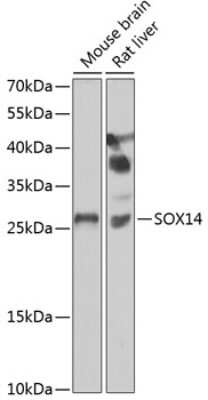 Western Blot: SOX14 Antibody [NBP2-93022] - Analysis of extracts of various cell lines, using SOX14 at 1:1000 dilution. Secondary antibody: HRP Goat Anti-Rabbit IgG (H+L) at 1:10000 dilution. Lysates/proteins: 25ug per lane. Blocking buffer: 3% nonfat dry milk in TBST. Detection: ECL Basic Kit . Exposure time: 90s.