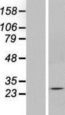 Western Blot: SOX14 Overexpression Lysate (Adult Normal) [NBP2-07901] Left-Empty vector transfected control cell lysate (HEK293 cell lysate); Right -Over-expression Lysate for SOX14.