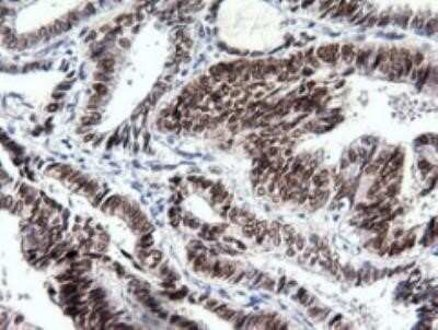 Immunohistochemistry: SOX17 Antibody (OTI2B6) - Azide and BSA Free [NBP2-74299] - Human endometrium tissue using anti-SOX17 mouse monoclonal antibody. Dilution Factor: 1:50; heat-induced epitope retrieval by 10mM citric buffer, pH6.0, 100 degrees C for 10min.