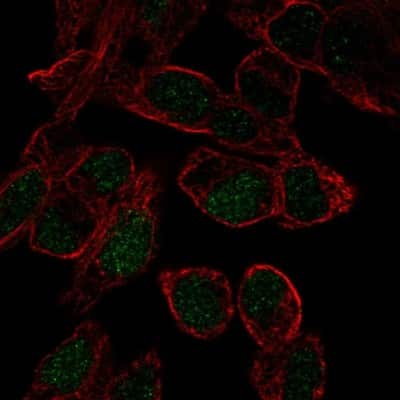 Immunocytochemistry/Immunofluorescence: SOX18 Antibody [NBP2-58004] - Staining of human cell line Hep G2 shows localization to nucleus. Antibody staining is shown in green.