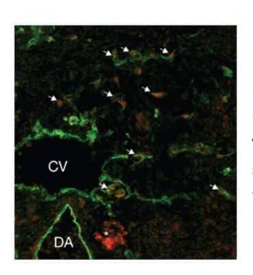 Immunocytochemistry/Immunofluorescence: SOX18 Antibody [NBP3-10962] - Immunofluorescence of mouse lymphatic endothelial cells using NBP3-10962