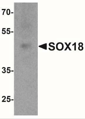 Western Blot: SOX18 Antibody [NBP2-41289] - Western blot analysis of SOX18 in 3T3 cell lysate with SOX18 antibody at 1 ug/ml.