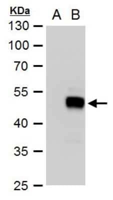 Western Blot: SOX18 Antibody [NBP2-43708] - Analysis of A. 30 ug 293T whole cell extract B. 30 ug whole cell lysate/extract of human SOX18-transfected 293T cells 12 % SDS-PAGE SOX18 antibody dilution: 1:20000.