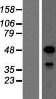 Western Blot: SOX18 Overexpression Lysate (Adult Normal) [NBP2-06802] Left-Empty vector transfected control cell lysate (HEK293 cell lysate); Right -Over-expression Lysate for SOX18.