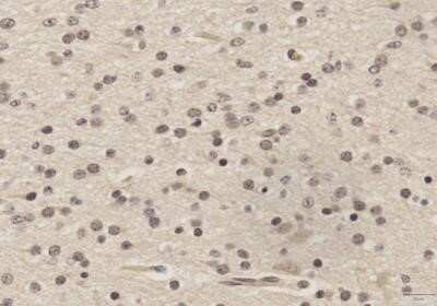 Immunohistochemistry-Paraffin: SOX2 Antibody (4G8) - Azide and BSA Free [NBP2-80957] - IHC analysis of formalin-fixed paraffin-embedded tissue section of normal human brain using mouse monoclonal SOX2 antibody (clone 4G8) at 5 ug/ml concentration. The representative photomicrograph depicts a cytoplasmic and nuclear immunopositivity of SOX2