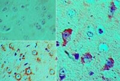 Immunohistochemistry-Paraffin: SOX2 Antibody [NBP2-27394] - Analysis of SOX2 in FFPE mouse brain tissue using an isotype control (top left) and this antibody (bottom left, right) at 5 ug/ml.