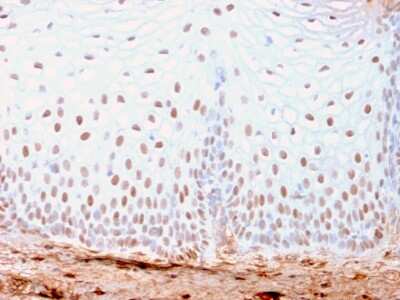 Immunohistochemistry-Paraffin: SOX2 Antibody (SOX2/3169R) - Azide and BSA Free [NBP3-08508] - Formalin-fixed, paraffin-embedded human Skin stained with SOX2 Recombinant Rabbit Monoclonal Antibody (SOX2/3169R).