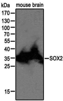 Western Blot: SOX2 Antibody [NBP2-27394] - Analysis of SOX2 in adult mouse brain using SOX2 antibody at 1:1000