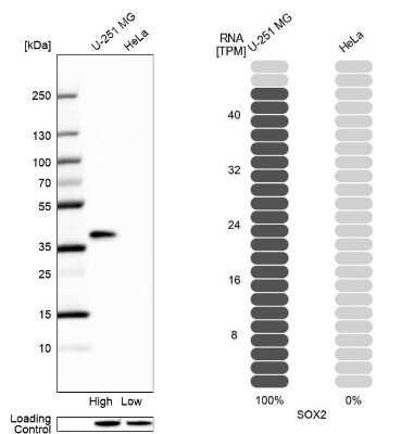 Western Blot: SOX2 Antibody [NBP2-58318] - Analysis in human cell line U-251 MG and human cell line HeLa.