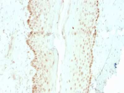 Immunohistochemistry-Paraffin: SOX2 Antibody (rSOX2/1792) [NBP3-07888] - Formalin-fixed, paraffin-embedded human cervix stained with SOX2 Recombinant Mouse Monoclonal Antibody (rSOX2/1792).