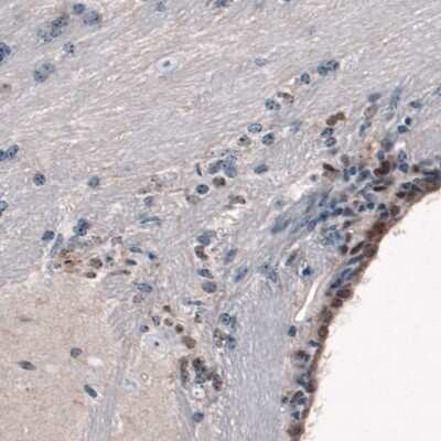 Immunohistochemistry-Paraffin: SOX21 Antibody (CL4681) [NBP2-59058] - Staining of mouse forebrain shows moderate nuclear immunoreactivity in a subset of cells in the lateral ventricle wall.