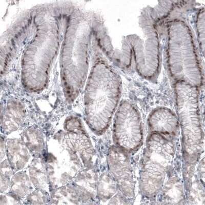 Immunohistochemistry-Paraffin: SOX21 Antibody (CL4681) [NBP2-59058] - Staining of human stomach shows moderate nuclear immunoreactivity in a subset of glandular cells.