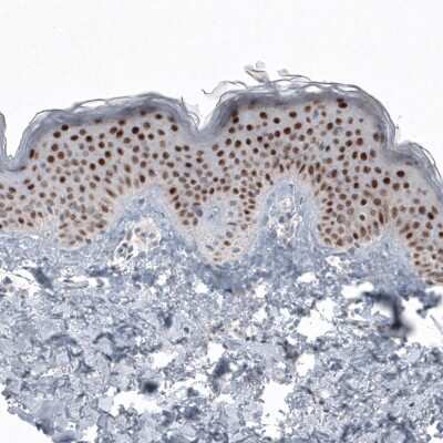 Immunohistochemistry-Paraffin: SOX21 Antibody (CL4681) [NBP2-59058] - Staining of human skin shows nuclear immunoreactivity in squamous epithelium cells.