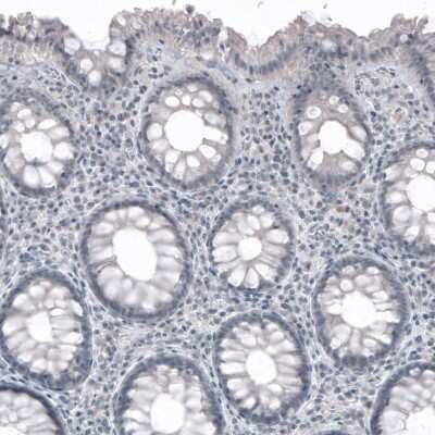 Immunohistochemistry-Paraffin: SOX21 Antibody (CL4681) [NBP2-59058] - Staining of human rectum shows no positivity as expected (negative control).