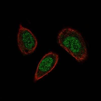 Immunocytochemistry/Immunofluorescence: SOX21 Antibody (CL4688) [NBP2-59059] - Staining of PC-3 cells using the Anti-SOX21 monoclonal antibody, showing specific staining in the nucleus in green. Microtubule- and nuclear probes are visualized in red and blue, respectively (where available).