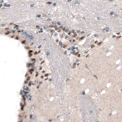 Immunohistochemistry-Paraffin: SOX21 Antibody (CL4688) [NBP2-59059] - Staining of mouse forebrain shows nuclear immunoreactivity in a subset of cells in the lateral ventricle wall.