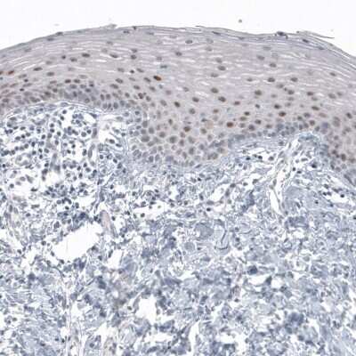 Immunohistochemistry-Paraffin: SOX21 Antibody (CL4688) [NBP2-59059] - Staining of human cervix shows moderate nuclear immunoreactivity in a subset of squamous epithelial cells.