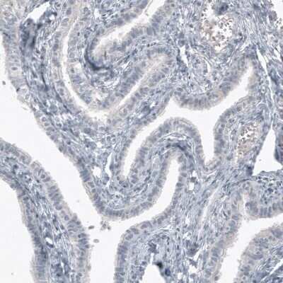 Immunohistochemistry-Paraffin: SOX21 Antibody (CL4688) [NBP2-59059] - Staining of human fallopian tube shows no positivity as expected (negative control).