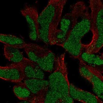 Immunocytochemistry/Immunofluorescence: SOX21 Antibody [NBP2-55988] - Staining of human cell line AF22 shows localization to nucleus.