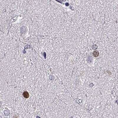 Immunohistochemistry: SOX21 Antibody [NBP2-68682] - Immunohistochemical staining of human caudate shows strong nuclear positivity in a subset of neuronal cells.