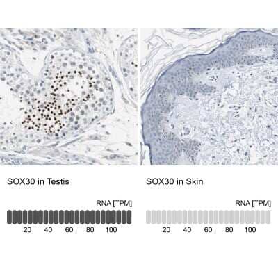 Immunohistochemistry-Paraffin: SOX30 Antibody [NBP1-86503] - Analysis in human testis and skin tissues using NBP1-86503 antibody. Corresponding SOX30 RNA-seq data are presented for the same tissues.