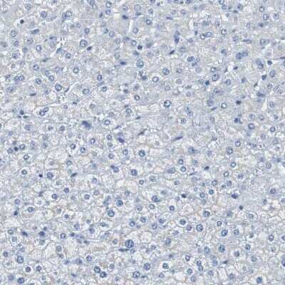 Immunohistochemistry-Paraffin: SOX30 Antibody [NBP1-86503] - Staining of human Liver shows no positivity in hepatocytes as expected.