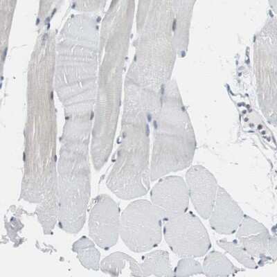 Immunohistochemistry-Paraffin: SOX30 Antibody [NBP1-86503] - Staining of human Skeletal muscle shows no positivity in myocytes as expected.