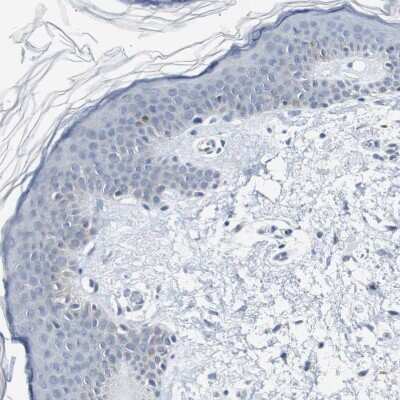 Immunohistochemistry-Paraffin: SOX30 Antibody [NBP1-86503] - Staining of human Skin shows no positivity in squamous epithelial cells as expected.