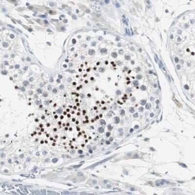 Immunohistochemistry-Paraffin: SOX30 Antibody [NBP1-86503] - Staining of human Testis shows strong nuclear positivity in spermatids.